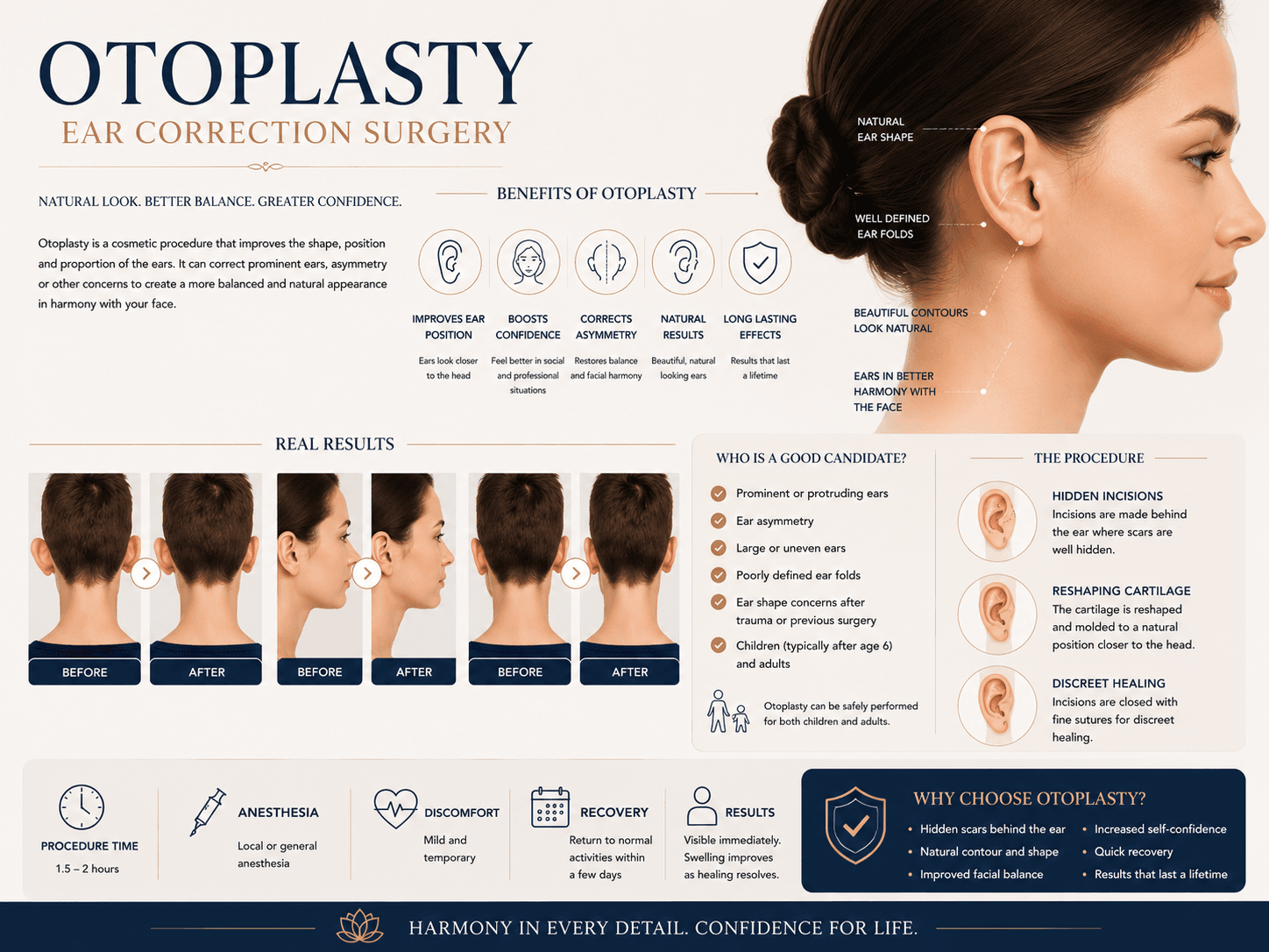 Alt=“otoplastia”